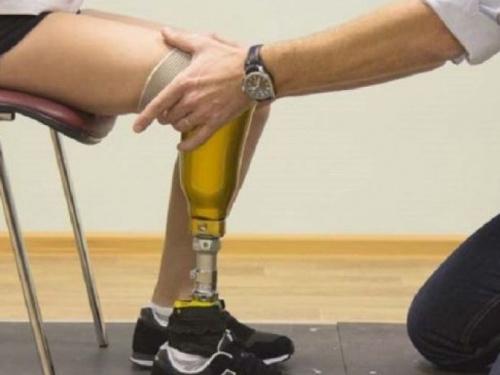 Управление соцзащиты населения Авдеевки обнародовало график работы протезистов на 2020 год 