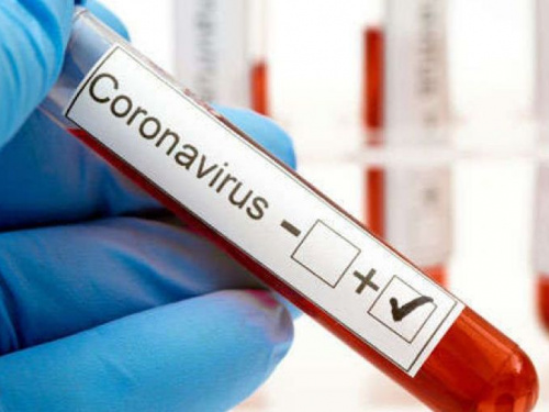 Рада постановила усилить тестирование на COVID-19