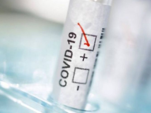 Частные лаборатории будут помогут государственным делать тесты на COVID-19