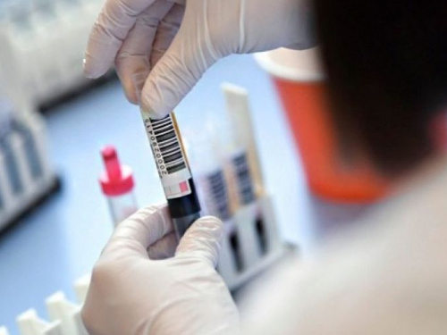 Эпидемия коронавирусной инфекции ускорила темпы в Украине