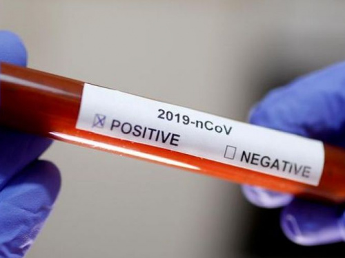 Государство будет платить частным лабораториям за ПЦР-тесты на COVID-19