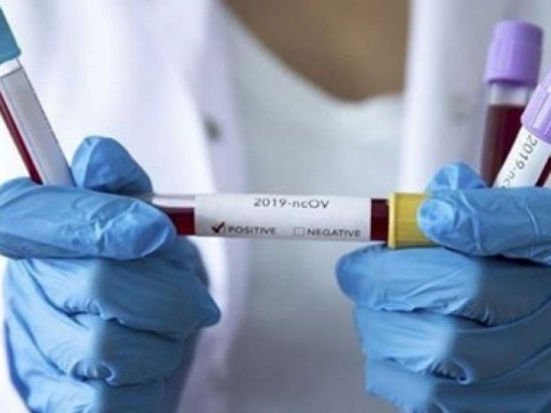 Эпидемия коронавирусной инфекции снова начинает набирать обороты в Украине