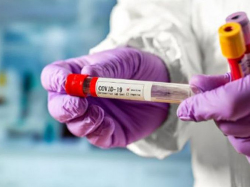 Число зараженных коронавирусом в Украине снова растет