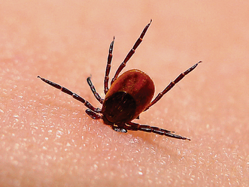 Что делать, если укусил клещ?