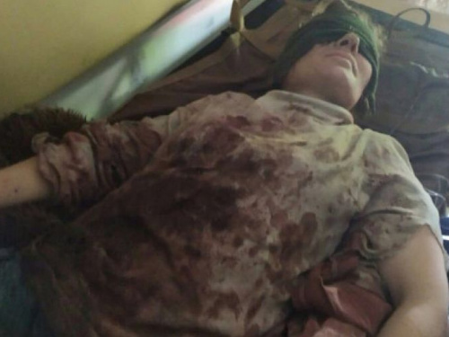 На мине подорвалась жительница Авдеевки