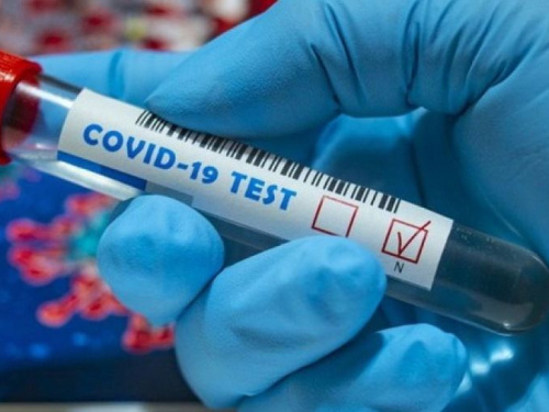 В Авдеевке лабораторно подтверждены 67 случаев COVID-19