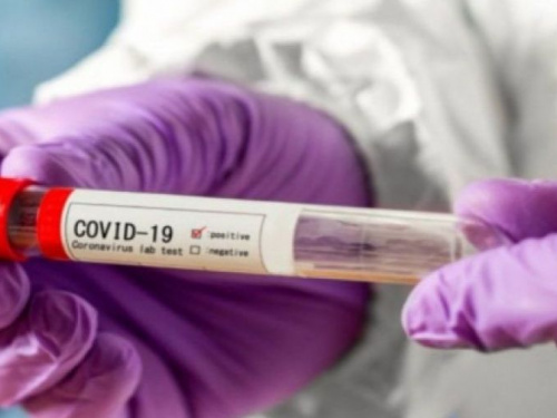 Тестирование на COVID-19 намерены сделать бесплатным