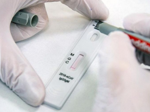 В 30% случаев у больного коронавирусом отрицательный ПЦР тест