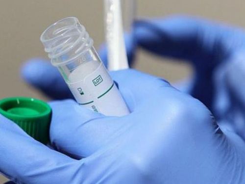 Очередь на ПЦР-тесты в Донецкой области намерены сократить до одного дня