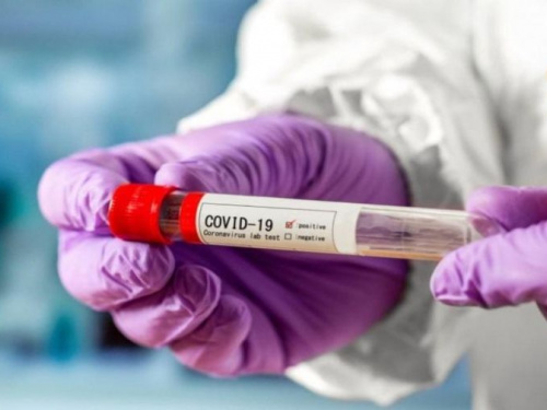 В Авдіївці за вихідні 85 захворівших на COVID-19