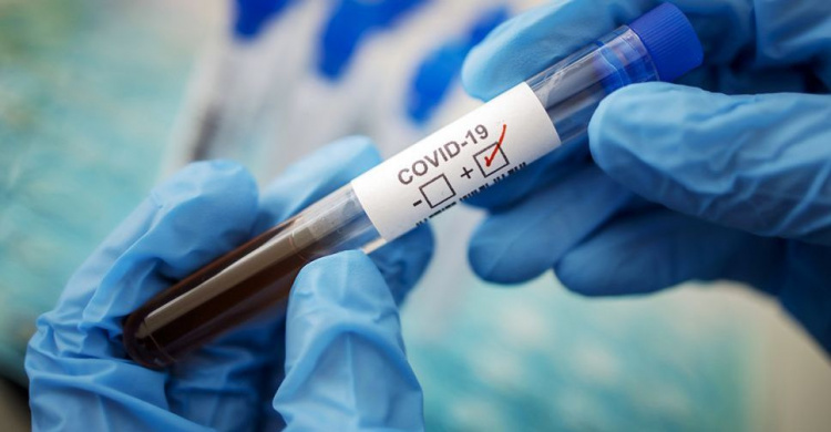 В Украине резко выросла заболеваемость COVID-19