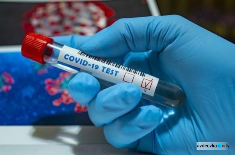 За добу захворіло на COVID-19 ще 34 мешканця Авдіївки, з них 3 дитини