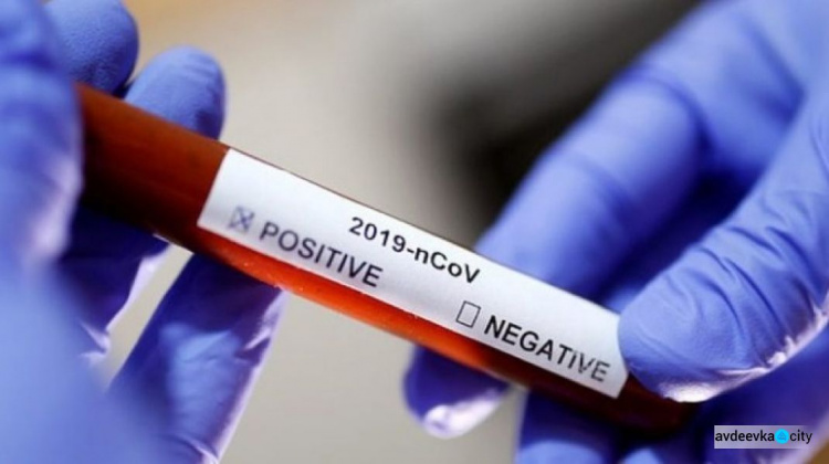 Эпидемия коронавирусной инфекции не сбавляет обороты в Украине