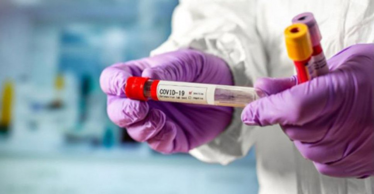 Число зараженных коронавирусом в Украине снова растет