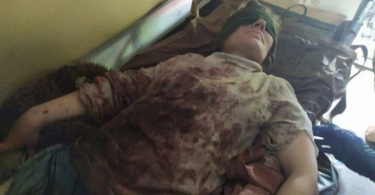 На мине подорвалась жительница Авдеевки