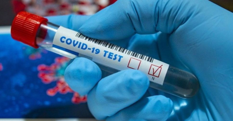 В Авдеевке лабораторно подтверждены 67 случаев COVID-19