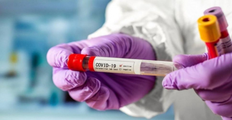 В Авдіївці за вихідні 85 захворівших на COVID-19